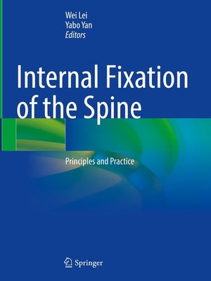 cover image of Internal Fixation of the Spine